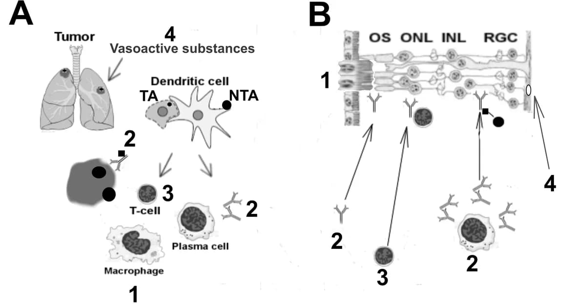 Diagram of immune cells and antibodies attacking the retina