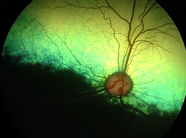 Normal canine fundus showing the tapetal region, optic nerve and retinal blood vessels
