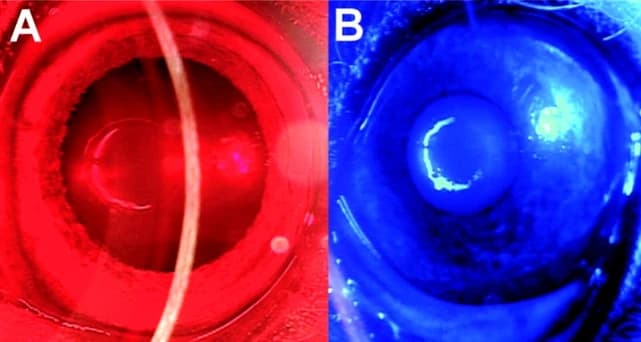 Clinical eye images under red and blue illumination