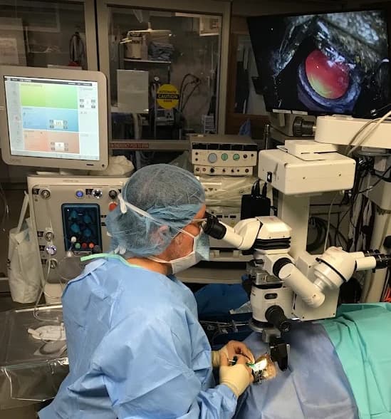 Cataract surgery using an operating microscope