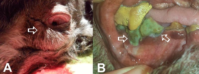 Postoperative swelling caused by dental disease