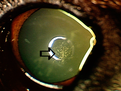 Small hereditary cataract in a mixed breed dog