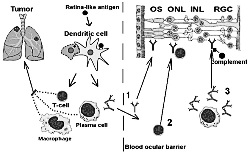 Proposed molecular mechanism of retinal damage in SARDS and IMR